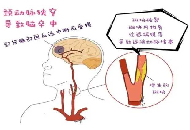 36439289668ccbcb08e2fc.png